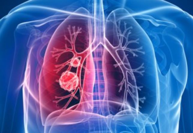 シフラ（コース内）