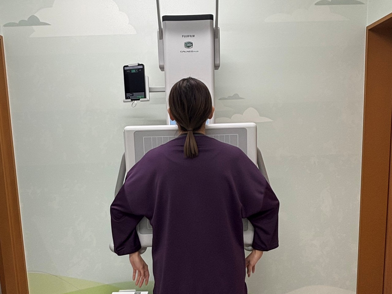 胸部レントゲン撮影